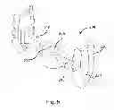 Fig. 07 - Blade anchor systems for bone fusion