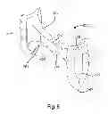 Fig. 09 - Blade anchor systems for bone fusion