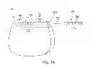 Fig. 04 - Electrical stimulation leads having RF compatibility and methods of use and manufacture