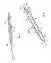 Fig. 06 - Implantable paddle lead comprising stretching electrical traces and method of fabrication