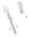Fig. 07 - Implantable paddle lead comprising stretching electrical traces and method of fabrication