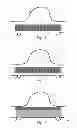 Fig. 02 - Stent with in situ determination of wall areas with differences in porosity