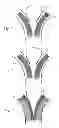 Fig. 04 - Stent with in situ determination of wall areas with differences in porosity