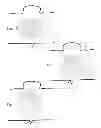 Fig. 05 - Stent with in situ determination of wall areas with differences in porosity