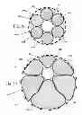 Fig. 13 - Stent with in situ determination of wall areas with differences in porosity