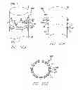 Fig. 15 - Modular graft component junctions