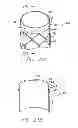 Fig. 16 - Modular graft component junctions