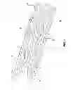 Fig. 02 - Bioabsorbable polymeric medical device