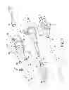 Fig. 02 - Preloaded wire for endoluminal device