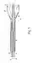 Fig. 06 - Preloaded wire for endoluminal device