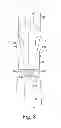 Fig. 09 - Preloaded wire for endoluminal device