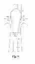Fig. 10 - Preloaded wire for endoluminal device