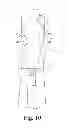 Fig. 11 - Preloaded wire for endoluminal device