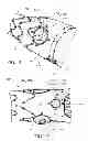 Fig. 15 - Preloaded wire for endoluminal device