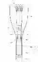 Fig. 17 - Preloaded wire for endoluminal device