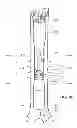 Fig. 20 - Preloaded wire for endoluminal device