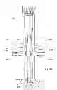 Fig. 29 - Preloaded wire for endoluminal device