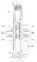 Fig. 31 - Preloaded wire for endoluminal device