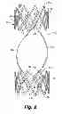 Fig. 03 - Fatigue-resistant flow regulating device and manufacturing methods
