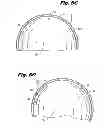 Fig. 09 - Fatigue-resistant flow regulating device and manufacturing methods