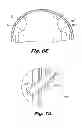 Fig. 10 - Fatigue-resistant flow regulating device and manufacturing methods