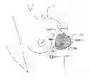 Fig. 01 - HUMAN IMPLANTABLE TISSUE EXPANDER