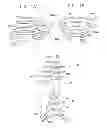 Fig. 02 - HUMAN IMPLANTABLE TISSUE EXPANDER