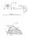 Fig. 04 - HUMAN IMPLANTABLE TISSUE EXPANDER
