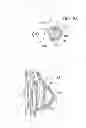Fig. 09 - HUMAN IMPLANTABLE TISSUE EXPANDER