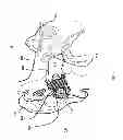 Fig. 02 - Methods and devices for radio frequency (RF) mitigation proximate the ear