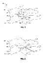 Fig. 02 - Cervical distraction method