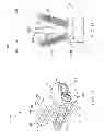 Fig. 13 - Facet interference cage
