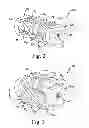 Fig. 03 - Expandable spinal interbody and intravertebral body devices