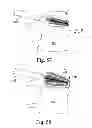 Fig. 23 - Expandable spinal interbody and intravertebral body devices