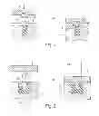 Fig. 03 - Method for fastening an implant to bone tissue and corresponding implant system