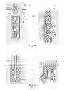 Fig. 06 - Method for fastening an implant to bone tissue and corresponding implant system