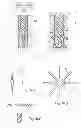 Fig. 07 - Method for fastening an implant to bone tissue and corresponding implant system