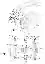 Fig. 02 - Convertible glenoid implant