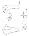 Fig. 04 - Arthroscopic total shoulder arthroplasty