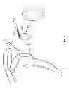 Fig. 05 - Arthroscopic total shoulder arthroplasty