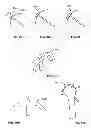 Fig. 08 - Arthroscopic total shoulder arthroplasty