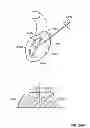 Fig. 19 - Arthroscopic total shoulder arthroplasty