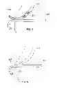 Fig. 03 - GROOVED PANCREATIC STENT