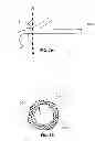 Fig. 05 - GROOVED PANCREATIC STENT
