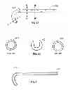 Fig. 06 - GROOVED PANCREATIC STENT
