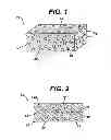 Fig. 02 - Method of preparation of bioabsorbable porous reinforced tissue implants and implants thereof