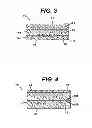 Fig. 03 - Method of preparation of bioabsorbable porous reinforced tissue implants and implants thereof