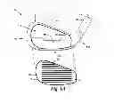 Fig. 02 - Golf club head