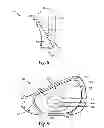 Fig. 08 - Golf club head