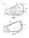 Fig. 09 - Golf club head